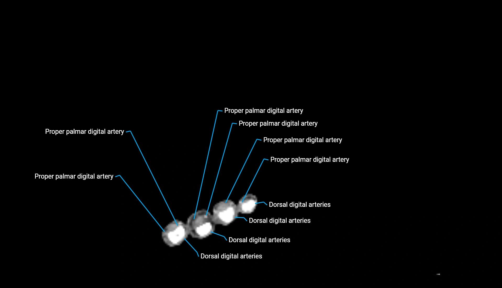 CTA upper limb axial cross sectional anatomy labelled image 27 (3).webp